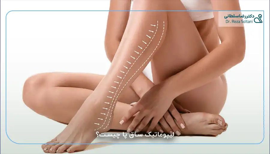 لیپوماتیک ساق پا چیست؟